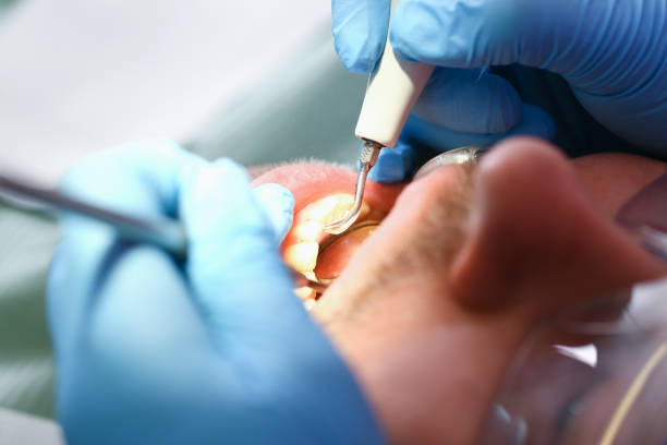 Best Mobile Emergency Dentist in West Union, OH